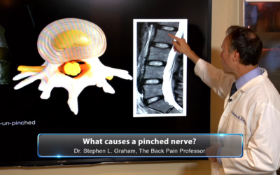 What is spinal stenosis?