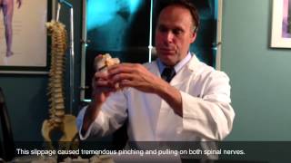 Scott had pain in both legs and in his feet. Dr. Graham corrected it with adjustments.