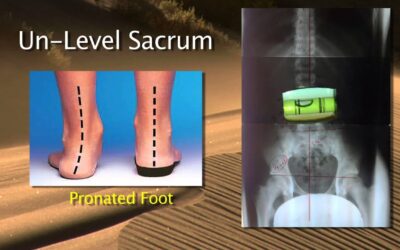 Are you on solid footing?